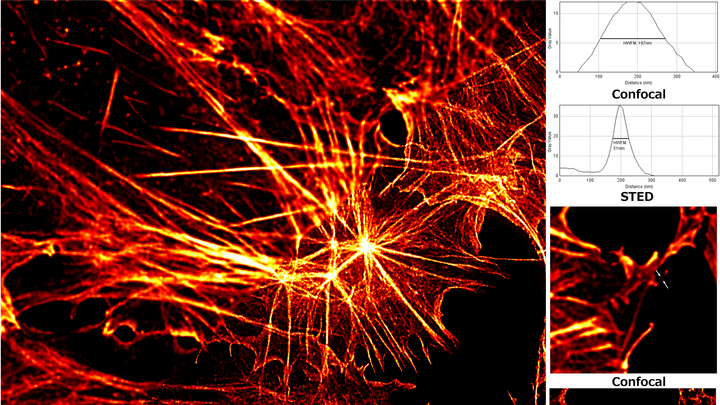 Welt Der Physik Optische Mikroskopie